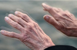 Khuyến nghị mở rộng xét nghiệm di truyền để phát hiện sớm bệnh Parkinson