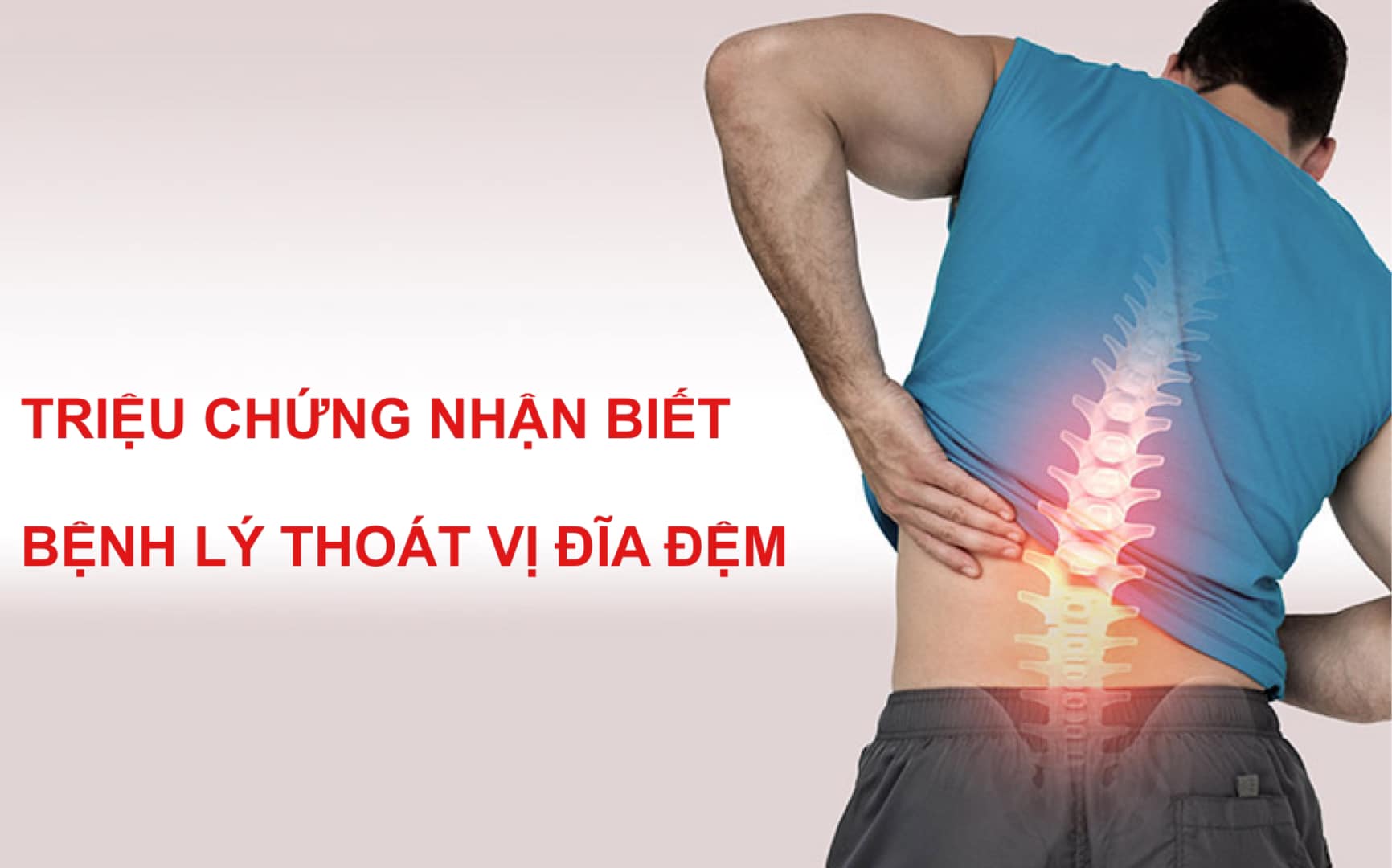 Đau lưng sau mổ thoát vị đĩa đệm? “Cứu tinh” của bạn là PHCN tại bệnh viện 199!