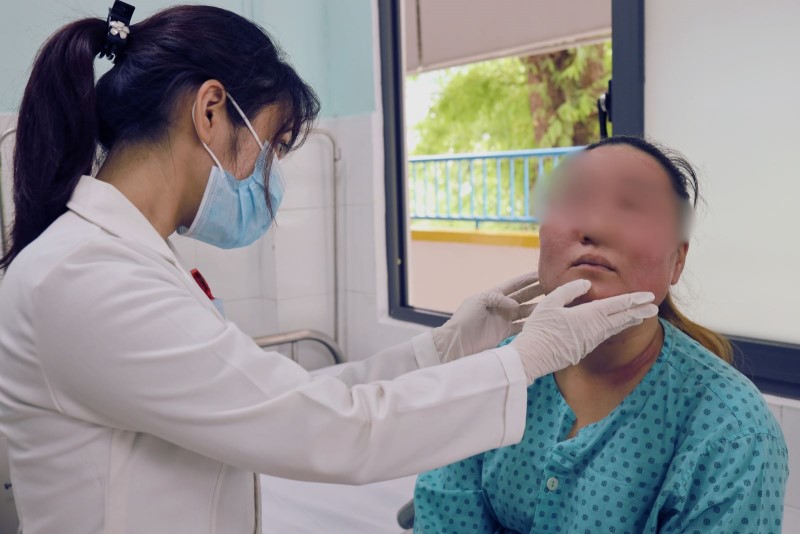 Cô gái 28 tuổi phải nhập viện sau khi sử dụng 'combo tái sinh làn da mới' mua trên mạng