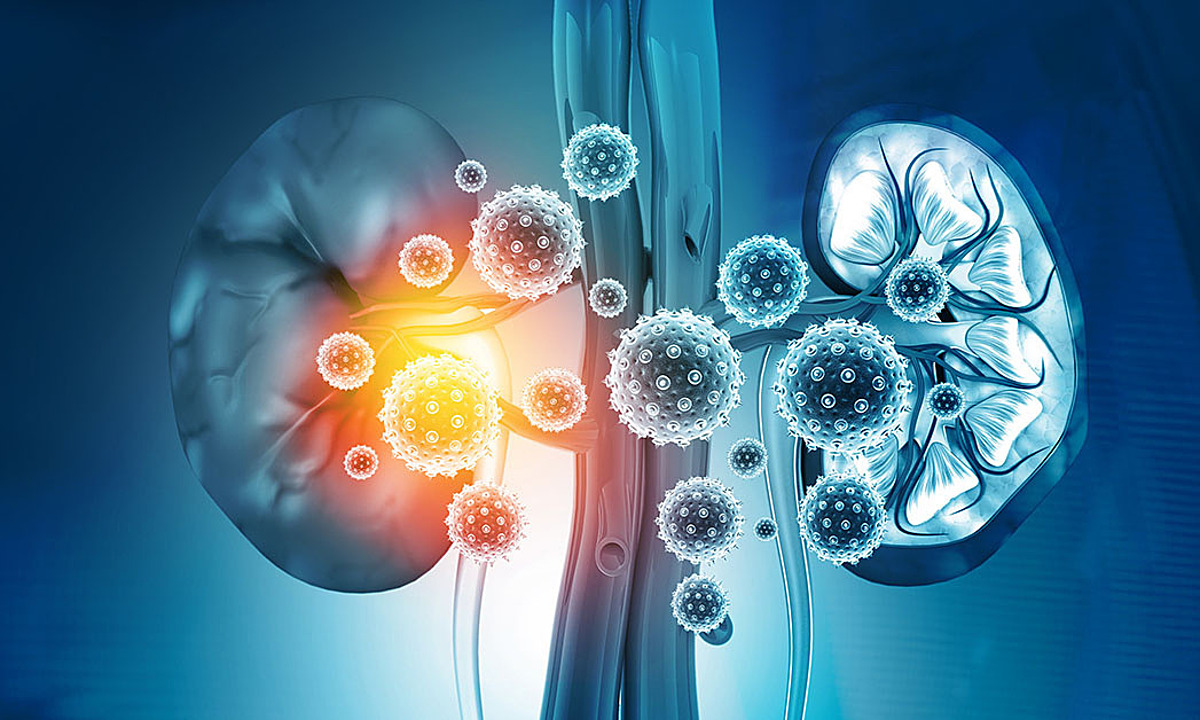 4 thói quen tốt ngừa suy thận