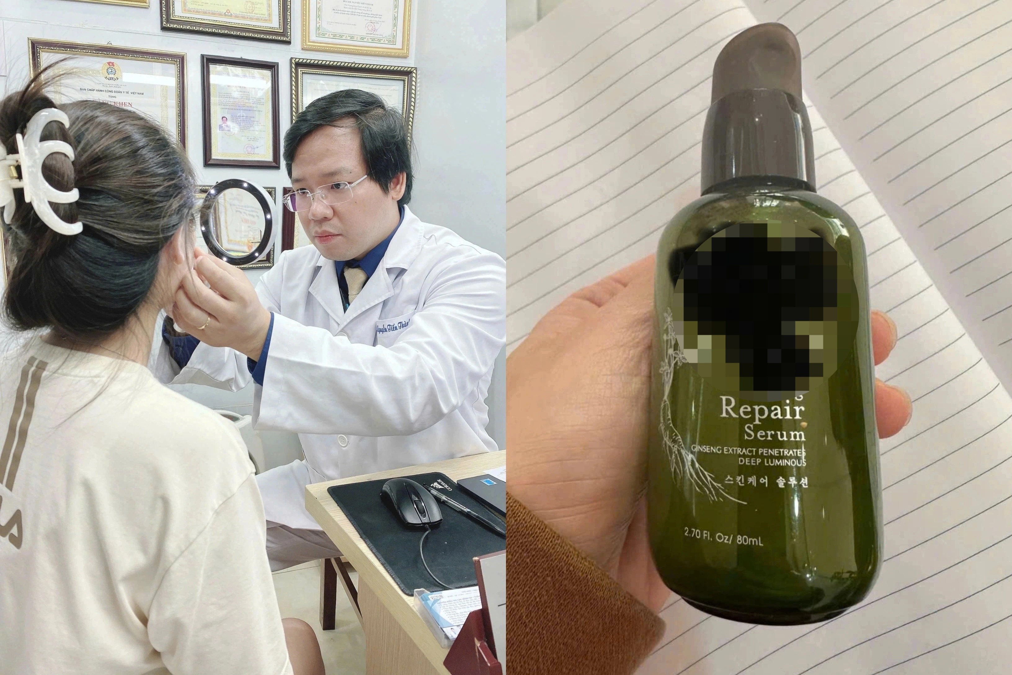 Nhiều chị em "môi cá trê" vì xăm môi giá rẻ đón Tết