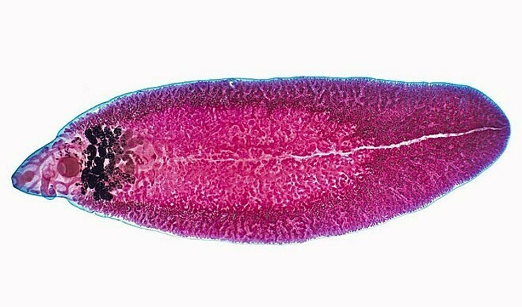 Người phụ nữ nhiễm hai loại ký sinh trùng từ chó nuôi