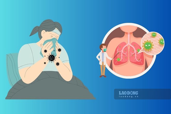 Cúm A/H1pdm có khả năng lây lan, trở thành dịch bệnh