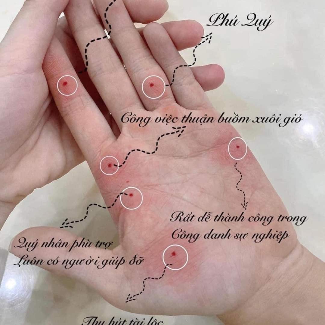 Rủi ro khi xăm nốt ruồi son 'đổi vận' năm mới